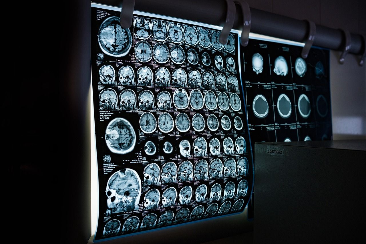 Nowe technologie w medycynie - jak technologia CFM rewolucjonizuje diagnostykę?
