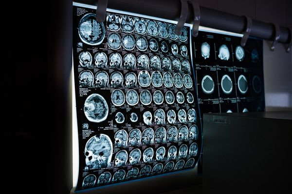 Nowe technologie w medycynie - jak technologia CFM rewolucjonizuje diagnostykę?